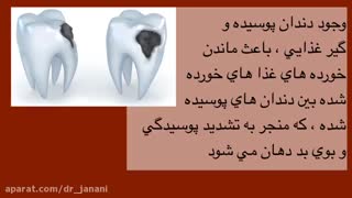 علل بوی بد دهان