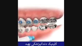 ارتودنسی دندان