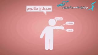 درمان سرطان پوست