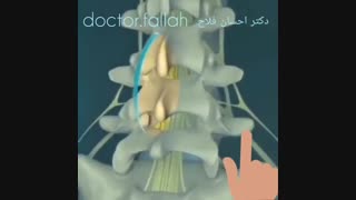 جراحی تعویض مفصل زانو