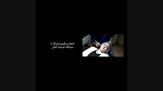 میکرونیدلینگ اصلاح فرم صورت