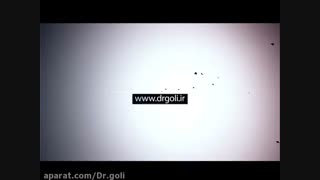 نحوه برداشتن چسب