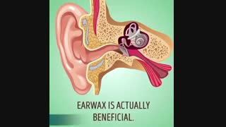 چرا نباید از گوش پاک کن استفاده کنیم