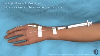 انیمیشن جراحی زیبایی بینی