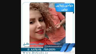 جراحی زیبایی بینی